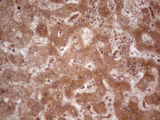 UBE2D2 / UBCH5B Antibody - Immunohistochemical staining of paraffin-embedded Human liver tissue within the normal limits using anti-UBE2D2 mouse monoclonal antibody. (Heat-induced epitope retrieval by 1 mM EDTA in 10mM Tris, pH8.5, 120C for 3min,