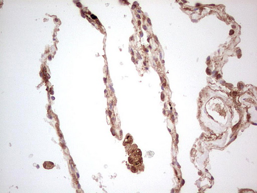 UBE2D2 / UBCH5B Antibody - Immunohistochemical staining of paraffin-embedded Human lung tissue within the normal limits using anti-UBE2D2 mouse monoclonal antibody. (Heat-induced epitope retrieval by 1 mM EDTA in 10mM Tris, pH8.5, 120C for 3min,
