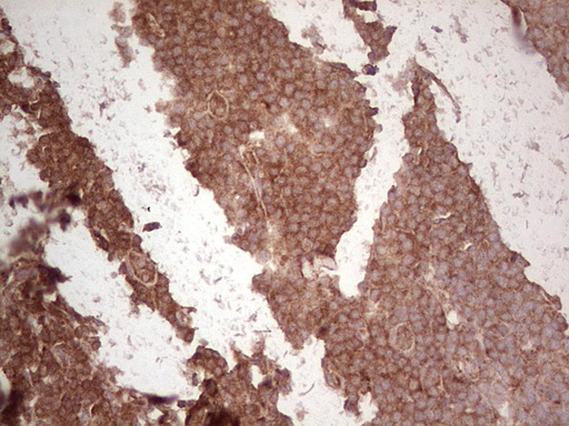 UBE2D2 / UBCH5B Antibody - IHC of paraffin-embedded Human tonsil using anti-UBE2D2 mouse monoclonal antibody. (Heat-induced epitope retrieval by 1 mM EDTA in 10mM Tris, pH8.5, 120°C for 3min).