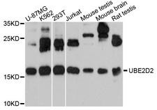 UBE2D2 / UBCH5B Antibody - Western blot analysis of extracts of various cell lines, using UBE2D2 antibody at 1:1000 dilution. The secondary antibody used was an HRP Goat Anti-Rabbit IgG (H+L) at 1:10000 dilution. Lysates were loaded 25ug per lane and 3% nonfat dry milk in TBST was used for blocking. An ECL Kit was used for detection and the exposure time was 90s.
