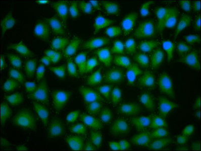 UBE2D2 / UBCH5B Antibody - Immunofluorescence staining of Hela cells with UBE2D2 Antibody at 1:100, counter-stained with DAPI. The cells were fixed in 4% formaldehyde, permeabilized using 0.2% Triton X-100 and blocked in 10% normal Goat Serum. The cells were then incubated with the antibody overnight at 4°C. The secondary antibody was Alexa Fluor 488-congugated AffiniPure Goat Anti-Rabbit IgG(H+L).