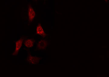 UBE2D2 / UBCH5B Antibody - Staining HeLa cells by IF/ICC. The samples were fixed with PFA and permeabilized in 0.1% Triton X-100, then blocked in 10% serum for 45 min at 25°C. The primary antibody was diluted at 1:200 and incubated with the sample for 1 hour at 37°C. An Alexa Fluor 594 conjugated goat anti-rabbit IgG (H+L) antibody, diluted at 1/600, was used as secondary antibody.
