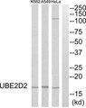 UBE2D2 / UBCH5B Antibody - Western blot analysis of extracts from HeLa cells, A549 cells and K562 cells, using UBE2D2 antibody.