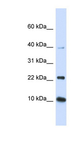 UBE2D2 / UBCH5B Antibody - UBE2D2 antibody Western blot of Fetal Brain lysate. This image was taken for the unconjugated form of this product. Other forms have not been tested.