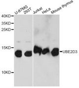 UBE2D3 / UBCH5C Antibody - Western blot analysis of extracts of various cell lines, using UBE2D3 antibody at 1:1000 dilution. The secondary antibody used was an HRP Goat Anti-Rabbit IgG (H+L) at 1:10000 dilution. Lysates were loaded 25ug per lane and 3% nonfat dry milk in TBST was used for blocking. An ECL Kit was used for detection and the exposure time was 15s.