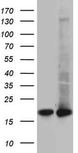 UBE2D4 Antibody - HEK293T cells were transfected with the pCMV6-ENTRY control. (Left lane) or pCMV6-ENTRY UBE2D4. (Right lane) cDNA for 48 hrs and lysed. Equivalent amounts of cell lysates. (5 ug per lane) were separated by SDS-PAGE and immunoblotted with anti-UBE2D4. (1:2000)