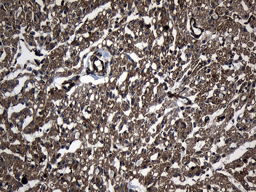 UBE2D4 Antibody - Immunohistochemical staining of paraffin-embedded Human adult heart tissue within the normal limits using anti-UBE2D4 mouse monoclonal antibody. (Heat-induced epitope retrieval by 1mM EDTA in 10mM Tris buffer. (pH8.5) at 120 oC for 3 min. (1:150)