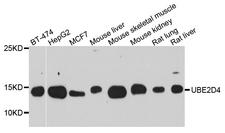 UBE2D4 Antibody - Western blot analysis of extract of various cells.