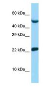 UBE2E1 / UBCH6 Antibody - UBE2E1 / UBCH6 antibody Western Blot of 721_B.  This image was taken for the unconjugated form of this product. Other forms have not been tested.