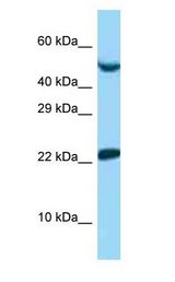 UBE2E1 / UBCH6 Antibody - UBE2E1 / UBCH6 antibody Western Blot of 721_B.  This image was taken for the unconjugated form of this product. Other forms have not been tested.
