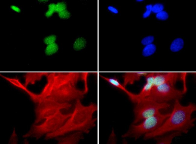 UBE2E1 / UBCH6 Antibody - Immunocytochemistry/Immunofluorescence: UBCH6 Antibody - UBCH6 antibody was tested in HeLa cells with FITC (green). Nuclei and alpha-tubulin were counterstained with DAPI (blue) and Dylight 594 (red).  This image was taken for the unconjugated form of this product. Other forms have not been tested.