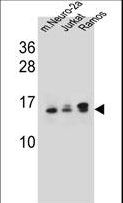 UBE2E2 / UBCH8 Antibody - UBE2E2 Antibody western blot of mouse Neuro-2a,Jurkat,Ramos cell line lysates (35 ug/lane). The UBE2E2 antibody detected the UBE2E2 protein (arrow).