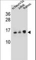 UBE2E2 / UBCH8 Antibody - UBE2E2 Antibody western blot of mouse Neuro-2a,Jurkat,Ramos cell line lysates (35 ug/lane). The UBE2E2 antibody detected the UBE2E2 protein (arrow).