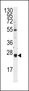UBE2E3 Antibody - Western blot of anti-UBCH9 Antibody in Y79 cell line lysates (35 ug/lane). UBCH9 (arrow) was detected using the purified antibody.