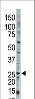 UBE2E3 Antibody - The anti-UBCH9 antibody is used in Western blot to detect UBCH9 in Jurkat cell lysate.
