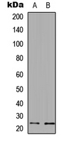 UBE2E3 Antibody - Western blot analysis of UBE2E3 expression in A549 (A); PC12 (B) whole cell lysates.