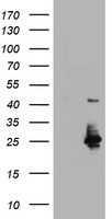 UBE2E3 Antibody - HEK293T cells were transfected with the pCMV6-ENTRY control (Left lane) or pCMV6-ENTRY UBE2E3 (Right lane) cDNA for 48 hrs and lysed. Equivalent amounts of cell lysates (5 ug per lane) were separated by SDS-PAGE and immunoblotted with anti-UBE2E3.