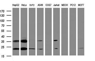 UBE2E3 Antibody - Western blot of extracts (35ug) from 9 different cell lines by using anti-UBE2E3 monoclonal antibody (HepG2: human; HeLa: human; SVT2: mouse; A549: human; COS7: monkey; Jurkat: human; MDCK: canine; PC12: rat; MCF7: human).