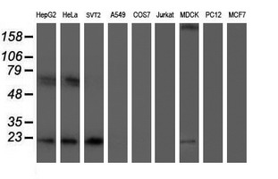 UBE2E3 Antibody - Western blot of extracts (35 ug) from 9 different cell lines by using g anti-UBE2E3 monoclonal antibody (HepG2: human; HeLa: human; SVT2: mouse; A549: human; COS7: monkey; Jurkat: human; MDCK: canine; PC12: rat; MCF7: human).