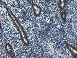 UBE2E3 Antibody - IHC of paraffin-embedded Human endometrium tissue using anti-UBE2E3 mouse monoclonal antibody.