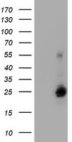 UBE2E3 Antibody - HEK293T cells were transfected with the pCMV6-ENTRY control (Left lane) or pCMV6-ENTRY UBE2E3 (Right lane) cDNA for 48 hrs and lysed. Equivalent amounts of cell lysates (5 ug per lane) were separated by SDS-PAGE and immunoblotted with anti-UBE2E3.