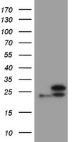 UBE2E3 Antibody - HEK293T cells were transfected with the pCMV6-ENTRY control (Left lane) or pCMV6-ENTRY UBE2E3 (Right lane) cDNA for 48 hrs and lysed. Equivalent amounts of cell lysates (5 ug per lane) were separated by SDS-PAGE and immunoblotted with anti-UBE2E3.