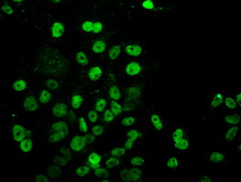 UBE2E3 Antibody - Anti-UBE2E3 mouse monoclonal antibody immunofluorescent staining of COS7 cells transiently transfected by pCMV6-ENTRY UBE2E3.