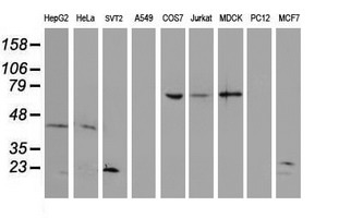 UBE2E3 Antibody - Western blot of extracts (35ug) from 9 different cell lines by using anti-UBE2E3 monoclonal antibody (HepG2: human; HeLa: human; SVT2: mouse; A549: human; COS7: monkey; Jurkat: human; MDCK: canine; PC12: rat; MCF7: human).