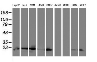 UBE2E3 Antibody - Western blot of extracts (35 ug) from 9 different cell lines by using anti-UBE2E3 monoclonal antibody (HepG2: human; HeLa: human; SVT2: mouse; A549: human; COS7: monkey; Jurkat: human; MDCK: canine; PC12: rat; MCF7: human).