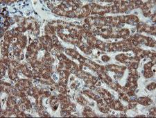 UBE2E3 Antibody - IHC of paraffin-embedded Human liver tissue using anti-UBE2E3 mouse monoclonal antibody.