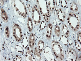 UBE2E3 Antibody - IHC of paraffin-embedded Human Kidney tissue using anti-UBE2E3 mouse monoclonal antibody. (Heat-induced epitope retrieval by 10mM citric buffer, pH6.0, 100C for 10min).