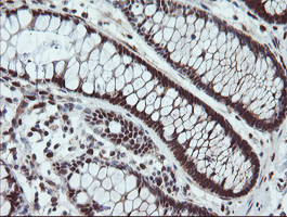 UBE2E3 Antibody - IHC of paraffin-embedded Human colon tissue using anti-UBE2E3 mouse monoclonal antibody. (Heat-induced epitope retrieval by 10mM citric buffer, pH6.0, 100C for 10min).