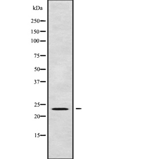 UBE2E3 Antibody - Western blot analysis UBE2E3 using HuvEc whole cells lysates