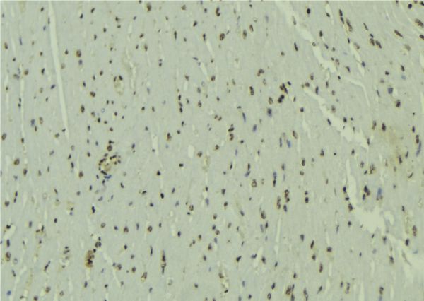 UBE2E3 Antibody - 1:100 staining mouse muscle tissue by IHC-P. The sample was formaldehyde fixed and a heat mediated antigen retrieval step in citrate buffer was performed. The sample was then blocked and incubated with the antibody for 1.5 hours at 22°C. An HRP conjugated goat anti-rabbit antibody was used as the secondary.