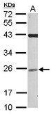 UBE2F Antibody - Sample (30 ug of whole cell lysate) A: NT2D1 12% SDS PAGE UBE2F antibody diluted at 1:1000