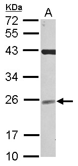 UBE2F Antibody - Sample (30 ug of whole cell lysate) A: NT2D1 12% SDS PAGE UBE2F antibody diluted at 1:1000