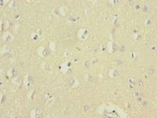 UBE2F Antibody - Immunohistochemistry of paraffin-embedded human brain tissue at dilution 1:100