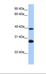 UBE2F Antibody - Hela cell lysate. Antibody concentration: 1.0 ug/ml. Gel concentration: 12%.  This image was taken for the unconjugated form of this product. Other forms have not been tested.