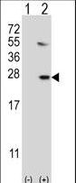 UBE2G1 Antibody - Western blot of UBE2G1 (arrow) using rabbit polyclonal UBE2G1 Antibody (R11). 293 cell lysates (2 ug/lane) either nontransfected (Lane 1) or transiently transfected (Lane 2) with the UBE2G1 gene.