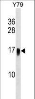 UBE2G1 Antibody - UBE2G1 Antibody western blot of Y79 cell line lysates (35 ug/lane). The UBE2G1 antibody detected the UBE2G1 protein (arrow).