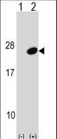 UBE2G1 Antibody - Western blot of UBE2G1 (arrow) using rabbit polyclonal UBE2G1 Antibody. 293 cell lysates (2 ug/lane) either nontransfected (Lane 1) or transiently transfected (Lane 2) with the UBE2G1 gene.