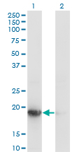 UBE2G1 Antibody - Western Blot analysis of UBE2G1 expression in transfected 293T cell line by UBE2G1 monoclonal antibody (M01), clone 1C12-1B2.Lane 1: UBE2G1 transfected lysate (Predicted MW: 19.5 KDa).Lane 2: Non-transfected lysate.