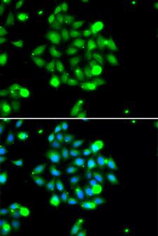 UBE2G1 Antibody - Immunofluorescence analysis of U20S cells.