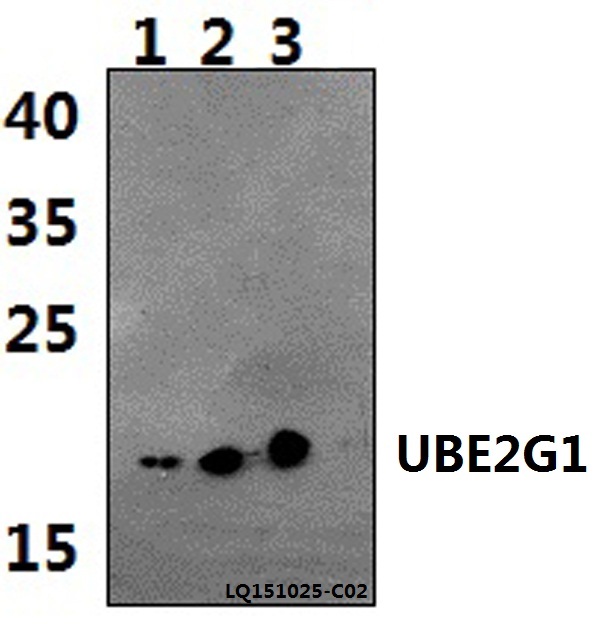 UBE2G1 Antibody - Western blot of UBE2G1 polyclonal antibody at 1:500 dilution. Lane 1: HeLa whole cell lysate (40 ug). Lane 2: NIH-3T3 whole cell lysate (40 ug). Lane 3: H9C2 whole cell lysate (40 ug).