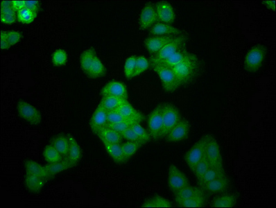 UBE2G1 Antibody - Immunofluorescence staining of HepG2 cells at a dilution of 1:166, counter-stained with DAPI. The cells were fixed in 4% formaldehyde, permeabilized using 0.2% Triton X-100 and blocked in 10% normal Goat Serum. The cells were then incubated with the antibody overnight at 4 °C.The secondary antibody was Alexa Fluor 488-congugated AffiniPure Goat Anti-Rabbit IgG (H+L) .