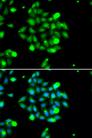 UBE2G1 Antibody - Immunofluorescence analysis of U2OS cells using UBE2G1 Polyclonal Antibody.