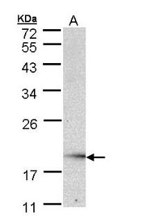 UBE2G2 Antibody - Sample (30 ug of whole cell lysate). A: Raji . 12% SDS PAGE. UBE2G2 antibody diluted at 1:1000