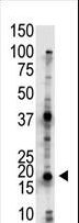 UBE2G2 Antibody - The anti-UBE2G2 antibody is used in Western blot to detect UBE2G2 in Jurkat cell lysate.