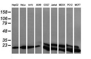 UBE2G2 Antibody - Western blot of extracts (35 ug) from 9 different cell lines by using g anti-UBE2G2 monoclonal antibody (HepG2: human; HeLa: human; SVT2: mouse; A549: human; COS7: monkey; Jurkat: human; MDCK: canine; PC12: rat; MCF7: human).