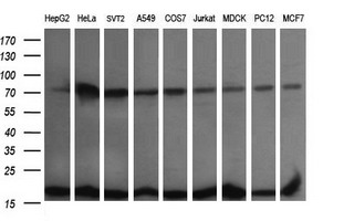 UBE2G2 Antibody - Western blot of extracts (35 ug) from 9 different cell lines by using anti-UBE2G2 monoclonal antibody (HepG2: human; HeLa: human; SVT2: mouse; A549: human; COS7: monkey; Jurkat: human; MDCK: canine; PC12: rat; MCF7: human).